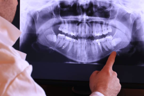 Best Emergency Gum Treatment in Mission, TX
