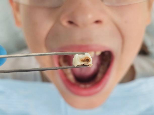 Best Same-Day Emergency Dental Services in Mission, TX